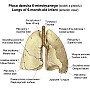pluca pulmones plen